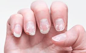 AI Nail Health Scanner